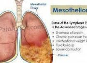 Define Mesothelioma In Medical Term