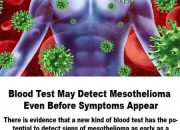Can Blood Test Detect Mesothelioma