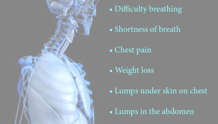 Very Early Symptoms Of Mesothelioma
