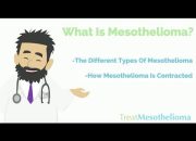 How Do You Treat Mesothelioma