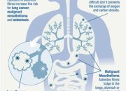 Can Mesothelioma Cause Lung Cancer