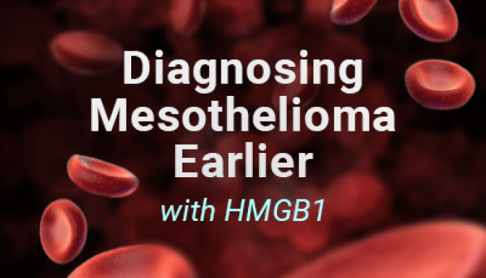 How Do You Diagnose Mesothelioma