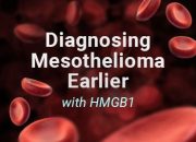 How Do Doctors Test For Mesothelioma