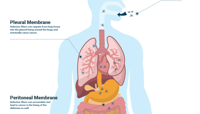 Which Body Organs Does Mesothelioma Mainly Affect